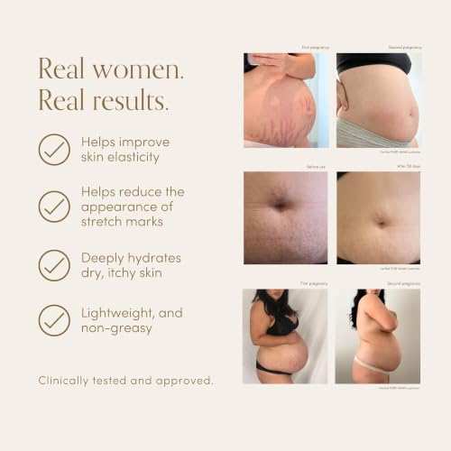 PURE MAMA Belly & Body Oil - Stretch Mark Oil for Pregnancy & Postpartum