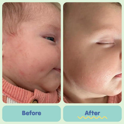 Tubby Todd All Over Ointment, Baby Eczema Cream for Sensitive Skin